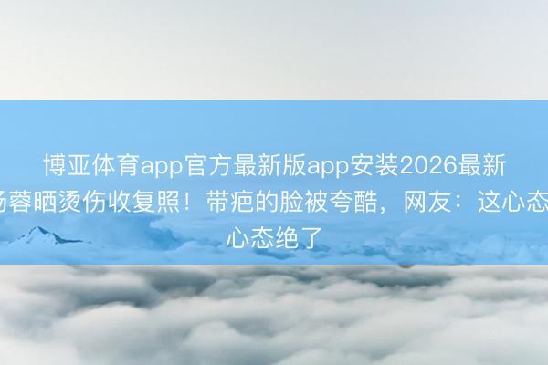 博亚体育app官方最新版app安装2026最新版 杨蓉晒烫伤收复照！带疤的脸被夸酷，网友：这心态绝了